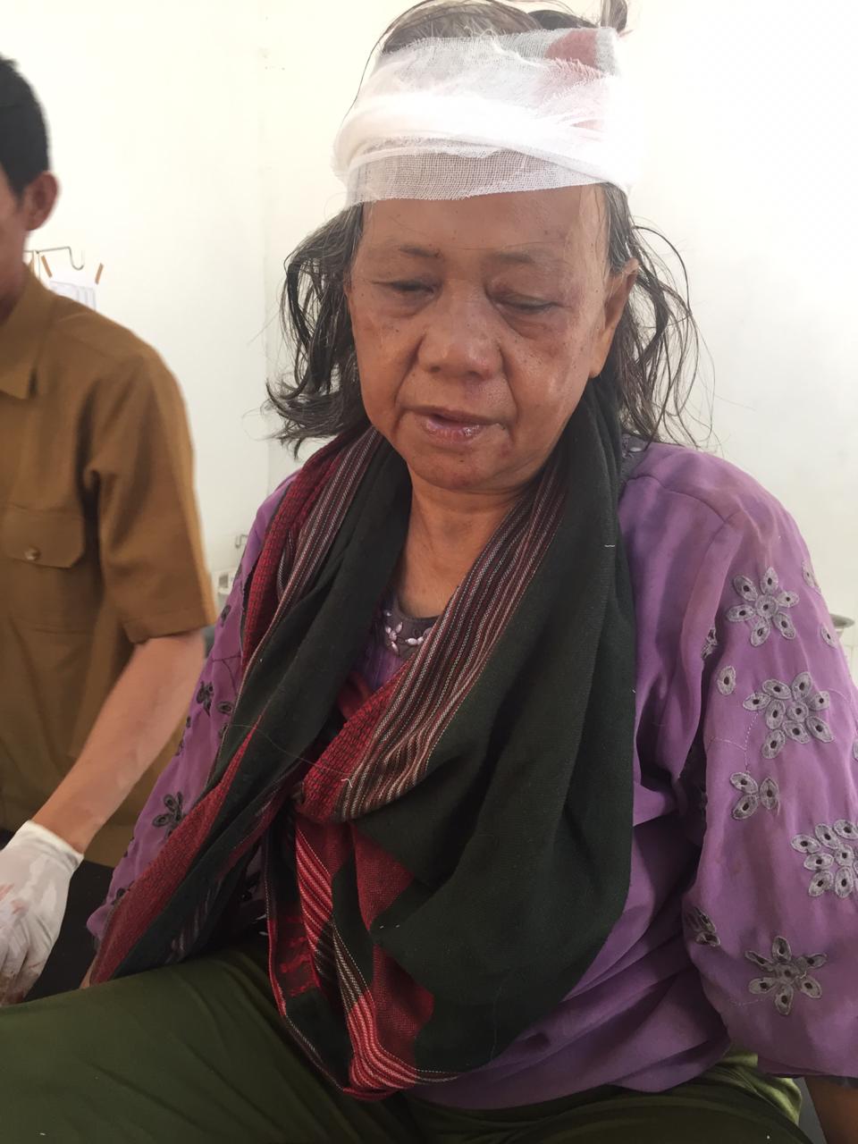 Warga Karossa, Korban Tabrak Lari di Salugatta Alami Luka di Kepala