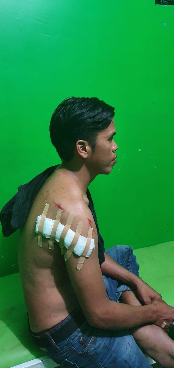 Diduga Karena Gangguan Jiwa, Ayah Aniaya Anak dan Istri Sendiri